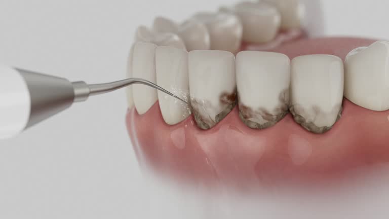 Reliable Dental Implants contractor in Rushville, IL by Smile Center Dentistry